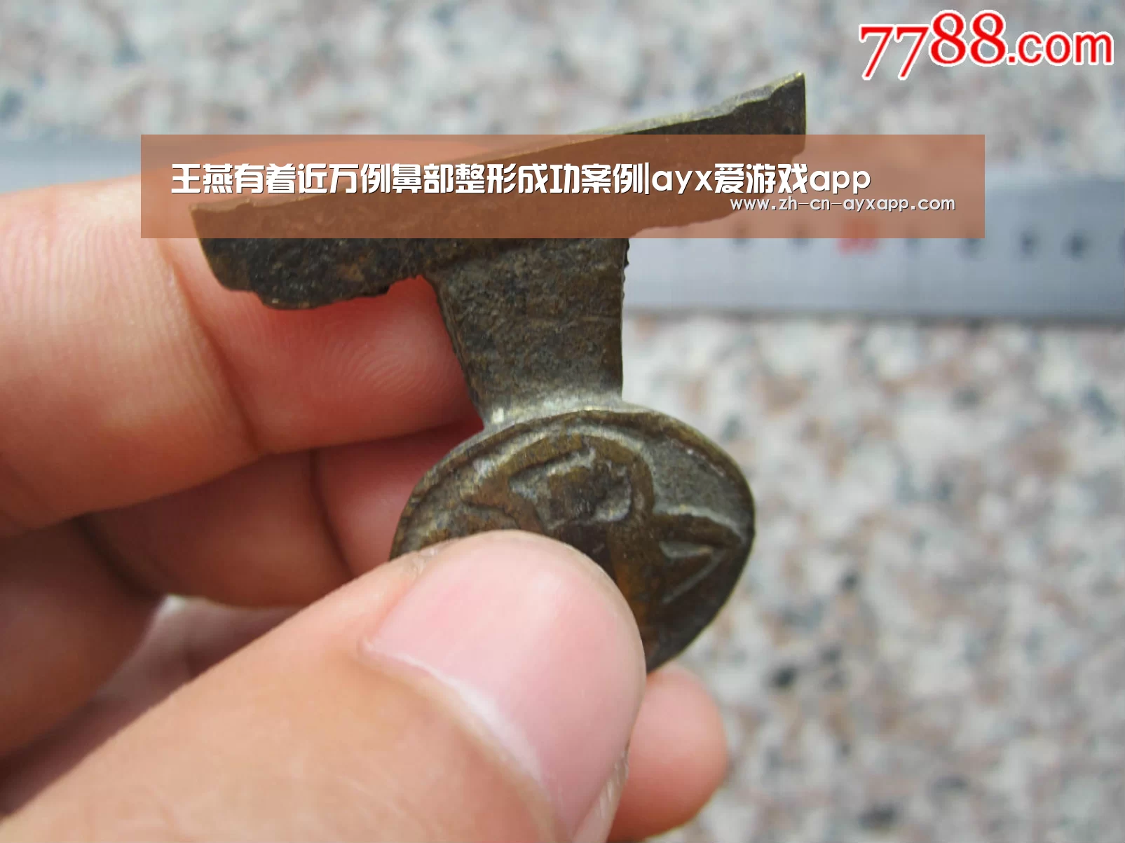 王燕有着近万例鼻部整形成功案例|ayx爱游戏app(图2) ayx爱游戏app